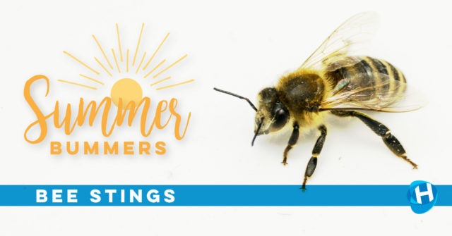Summer Bummers: Treating A Bee Sting